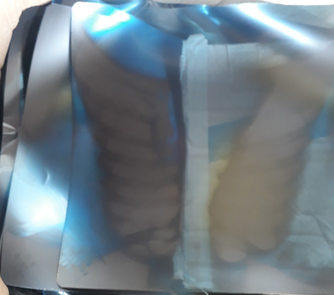 Aprox. 70Kg de Radiografia